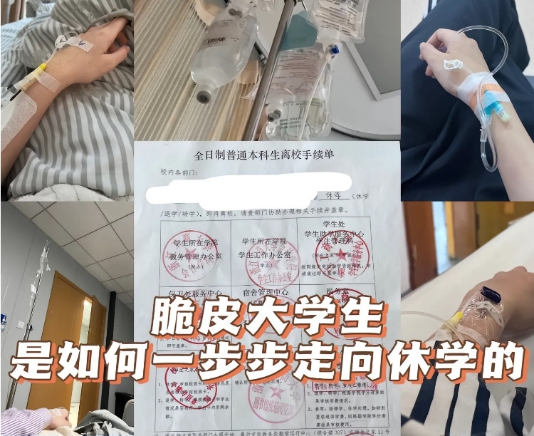 “脆皮大学生”续文! 主打一个脆但难杀, 真担心大学生的精神状态